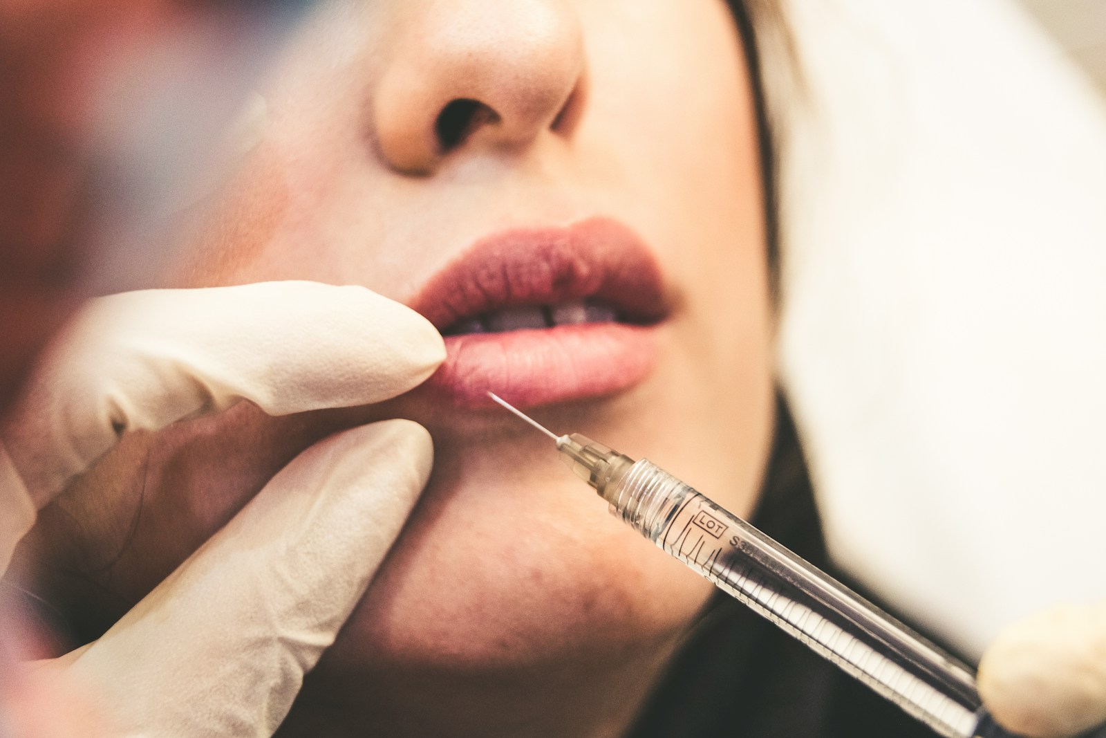 Lip Fillers in Truro: Highlight Your Natural Beauty Safely and Professionally